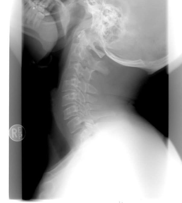 CICA Claim Solicitors in Cheshire